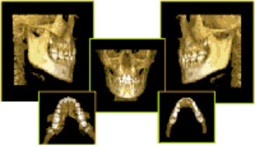 3. 歯を支えている骨の診断に必須な「CT」があります